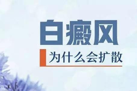 白癜风会不会扩散到脸上